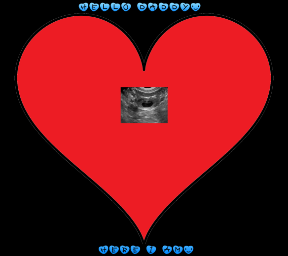 KARTKA PREURODZINOWO WALENTYNKOWA